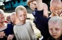 Des albinos persécutés et mutilés en Tanzanie